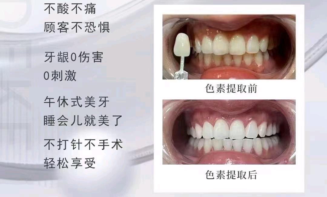 牙齿的美白之道