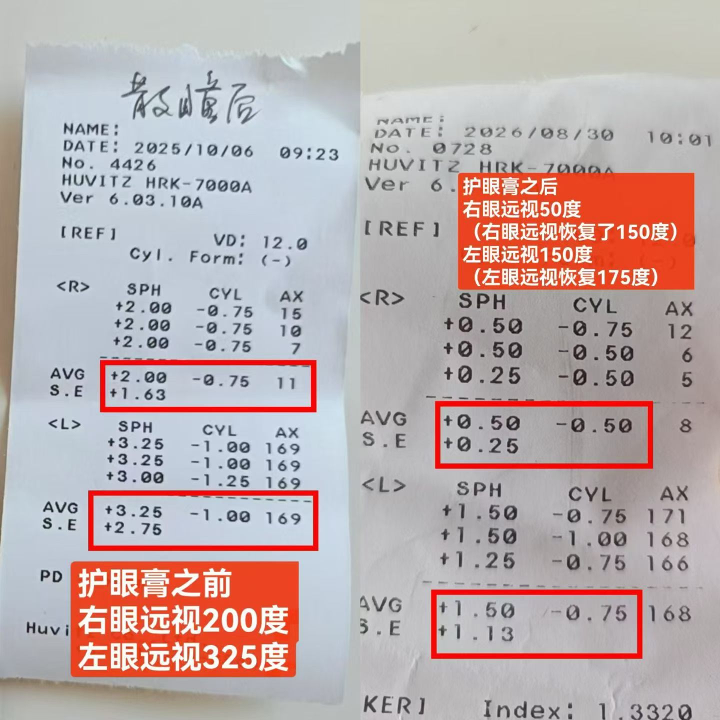 0囤货招护眼产品代理｜自用有效才分享｜可副业可全职｜有团队帮扶